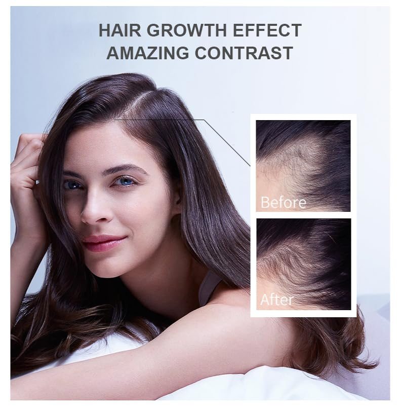 Hair Growth Oil Ginger Biotin  - Epidermal Growth Factor review and price