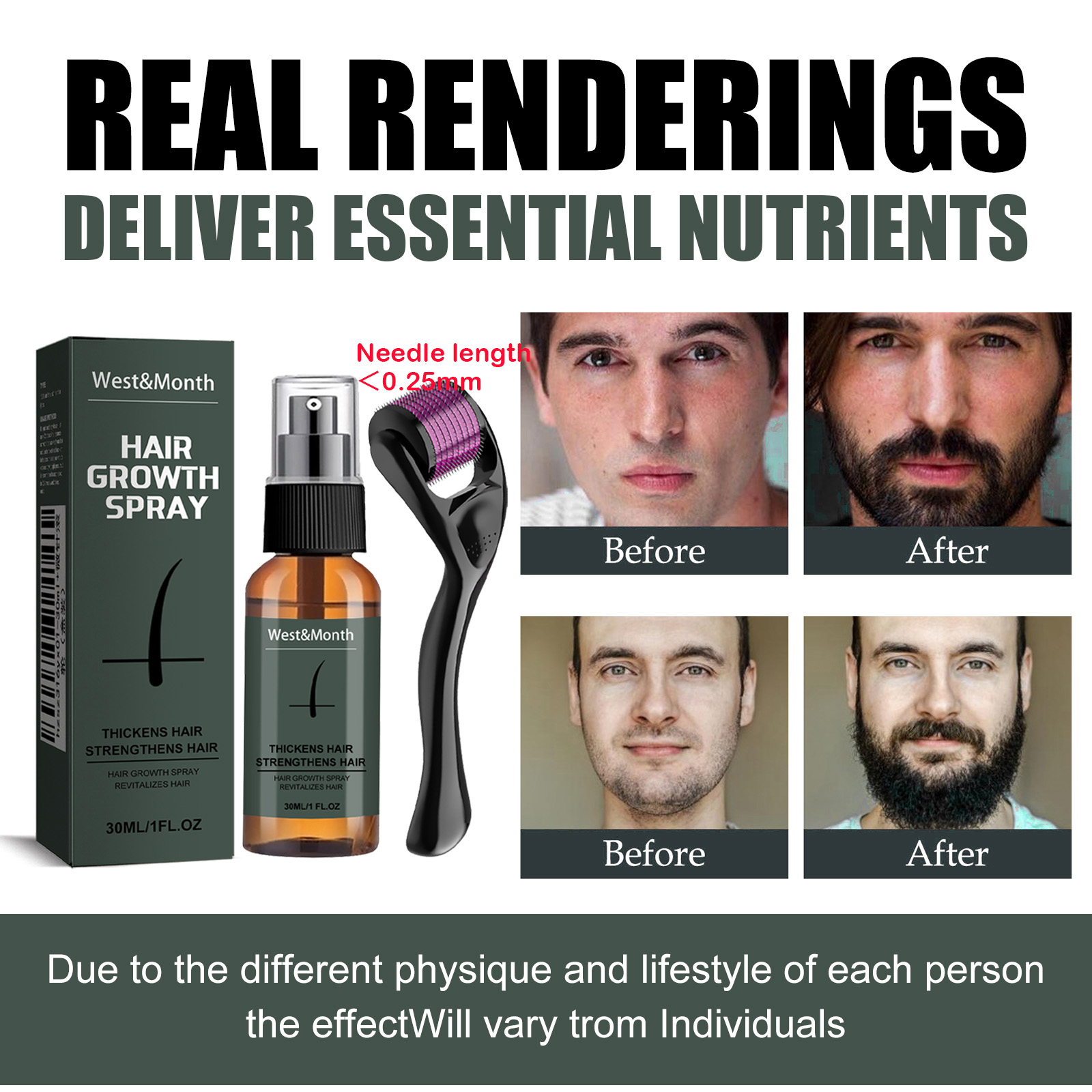 Men's Beard Spray Kit with Mic - Epidermal Growth Factor review and price