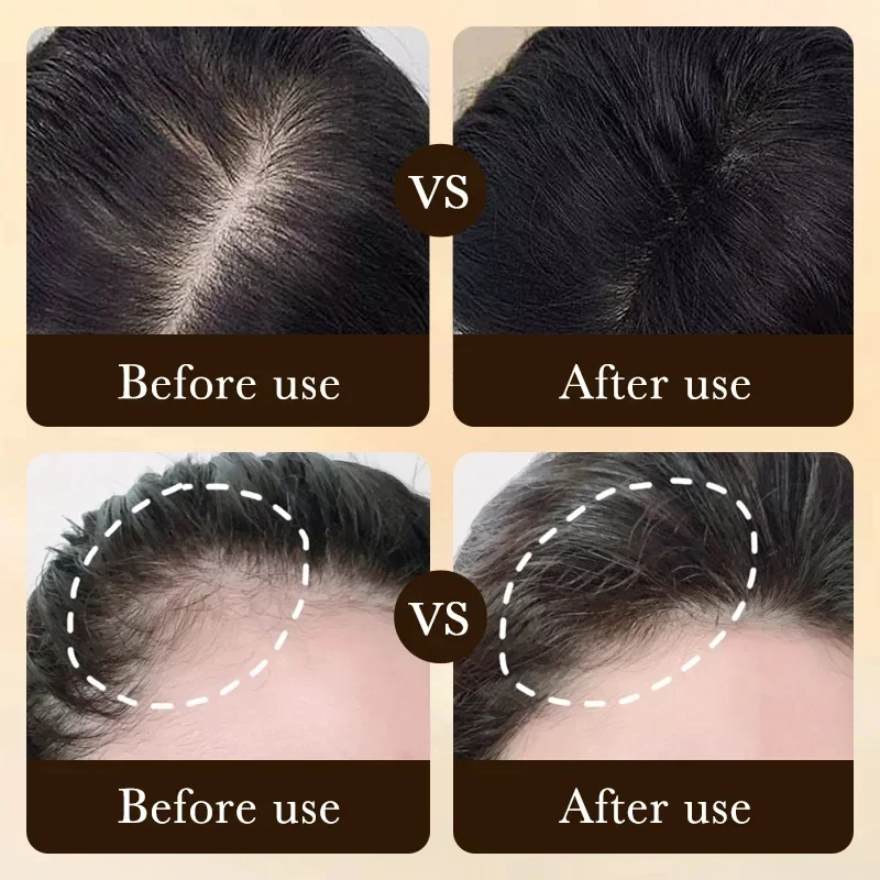 Biotin fast Hair Growth oil Pr - Epidermal Growth Factor review and price
