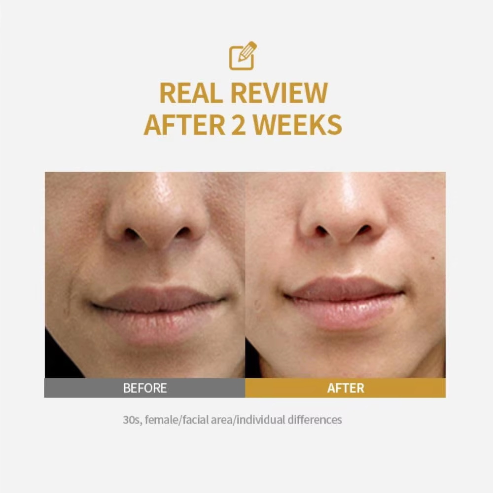 Peptide Intensive Lifting Ampo - Peptide Complex Serum review and price